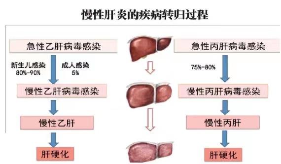 【健康科普】世界肝炎日——堅(jiān)持早預(yù)防，加強(qiáng)檢測發(fā)現(xiàn)，規(guī)范抗病毒治療